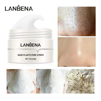 Nose plant pore strips. Use to clear unwanted nose acne and embrace less oily and clearer skin 